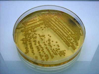 Clic pentru a vizualiza imaginea în dimensiunile reale