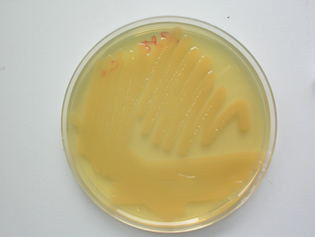 Vibrio anguillarum